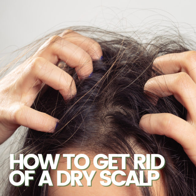 itchy dry scalp